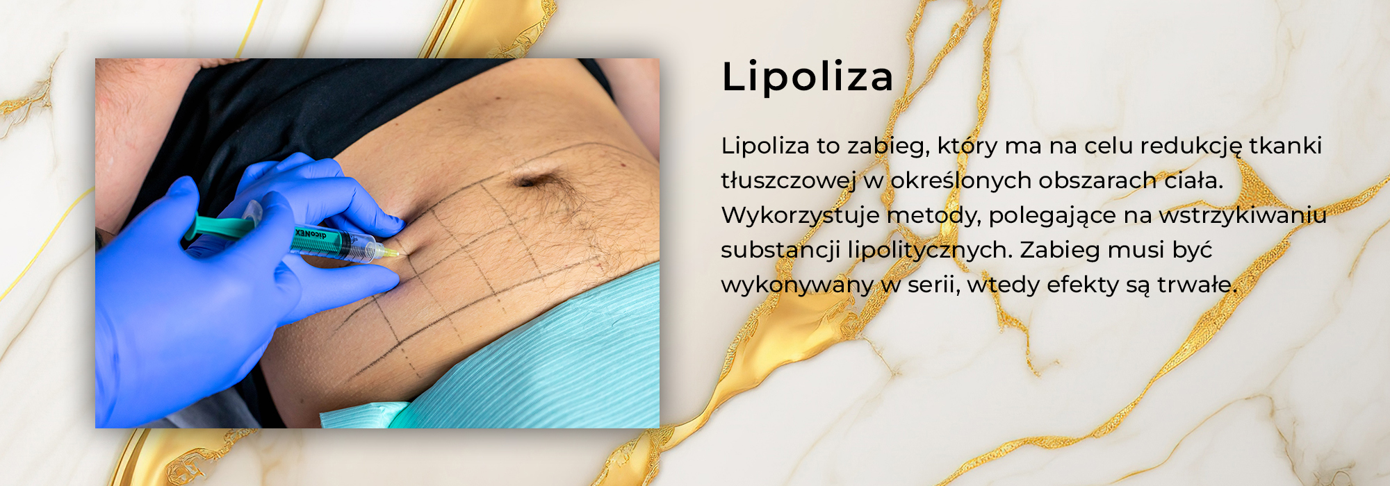 lipoliza