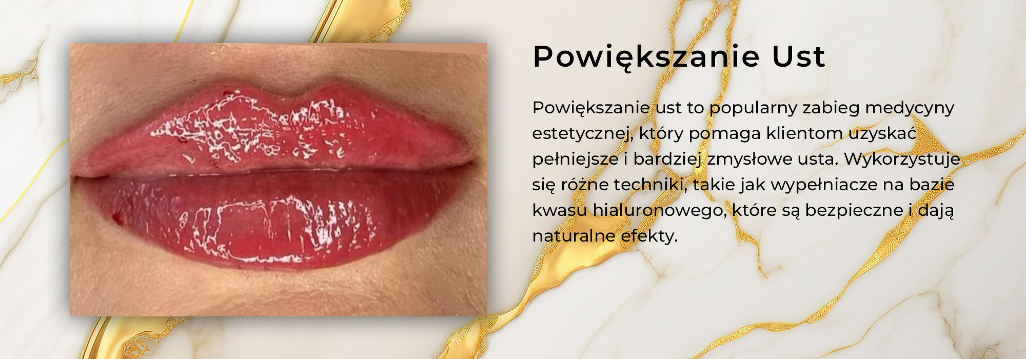 powiekszanie_ust_na_strone_gowna